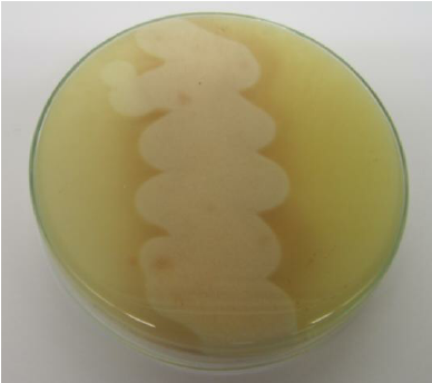 Egg Yolk Agar